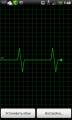 :   - Heart Monitor 